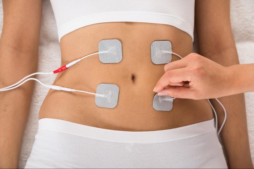 electrostimulation